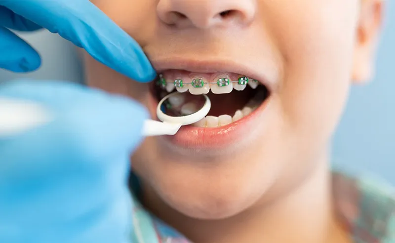 Early Orthodontic Treatment (Kids)
