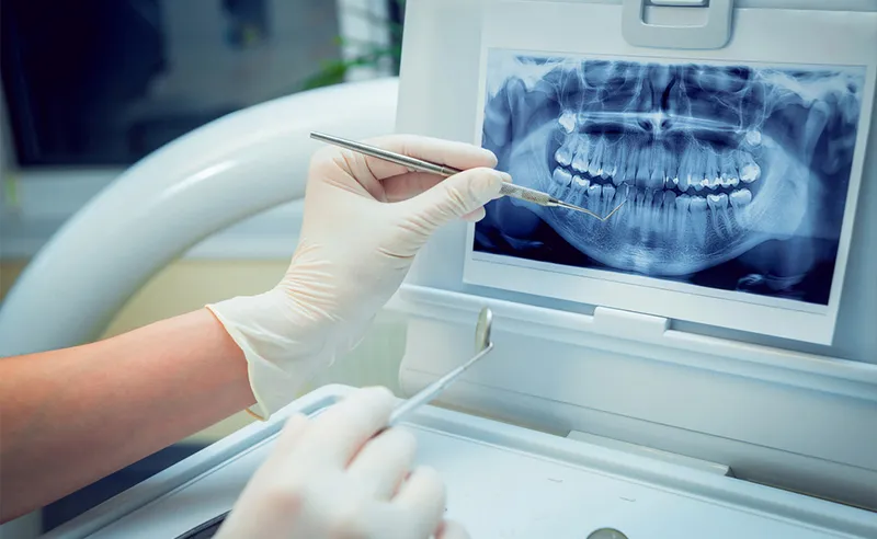 Surgical Orthodontics