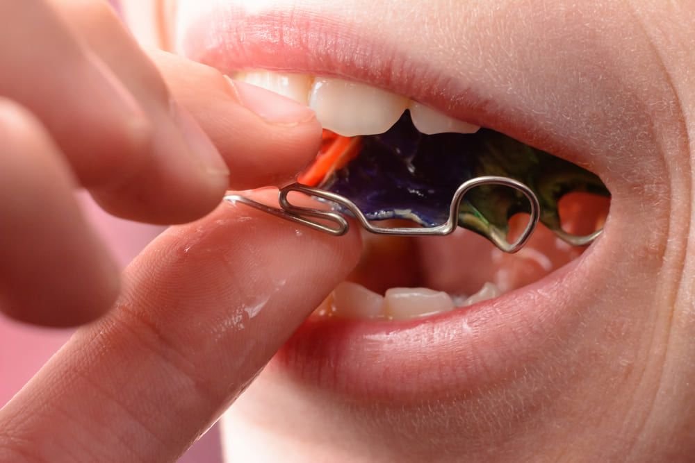 Retention & Aftercare