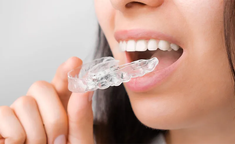 تقويم الاسنان للبالغين