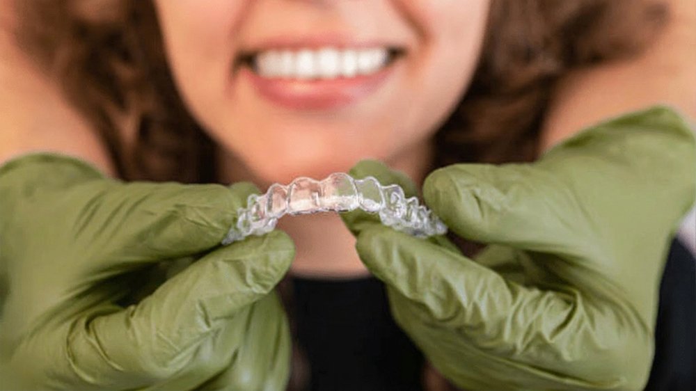 clear aligners results timeline